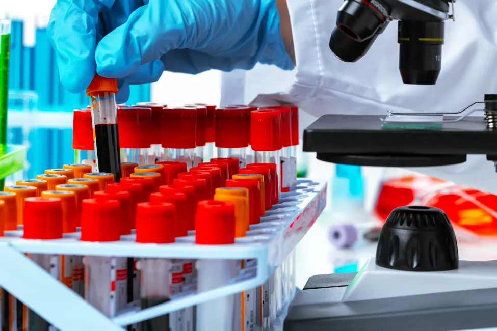 Scientist's hands doing chemical research with the help of microscope