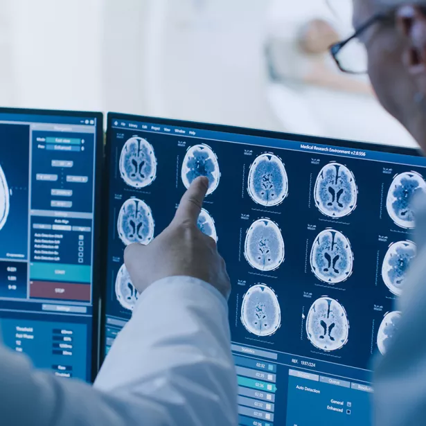 Medical professionals review cranial scans on a computer screen. Exponent data scientists help you capture the right data.