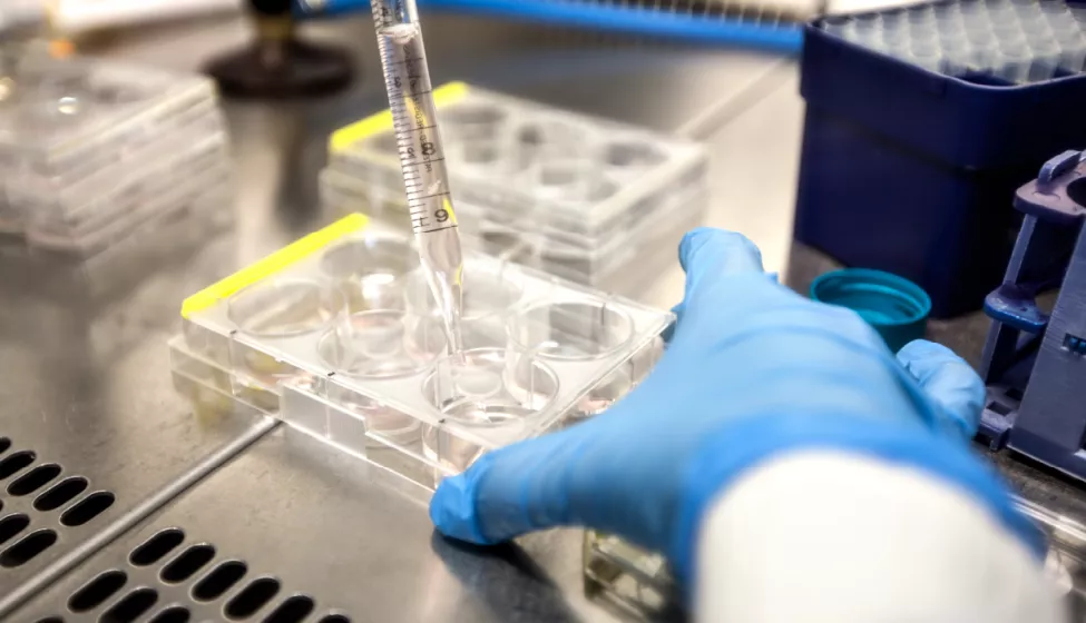 A scientist wearing a blue glove adds clear solution from a dropper to a tray of samples