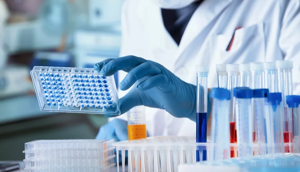 Scientist examining liquid test samples