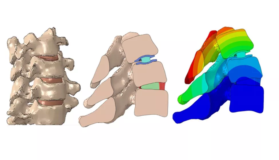 Evaluation of kinematics of a total disc replacement device